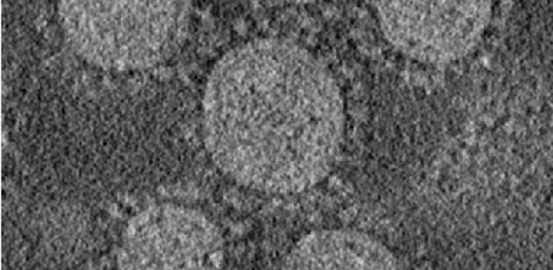 Coronaviridae: virion EM