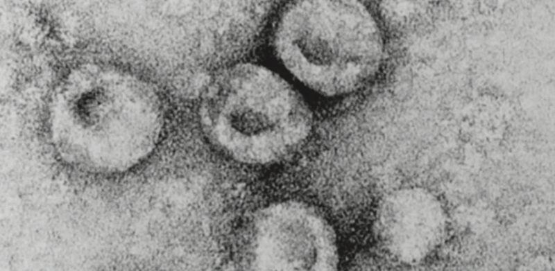 Bovine viral diarrhea virus 1